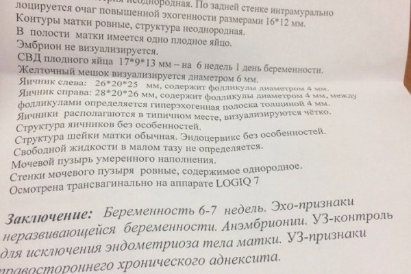 Kraken смылка